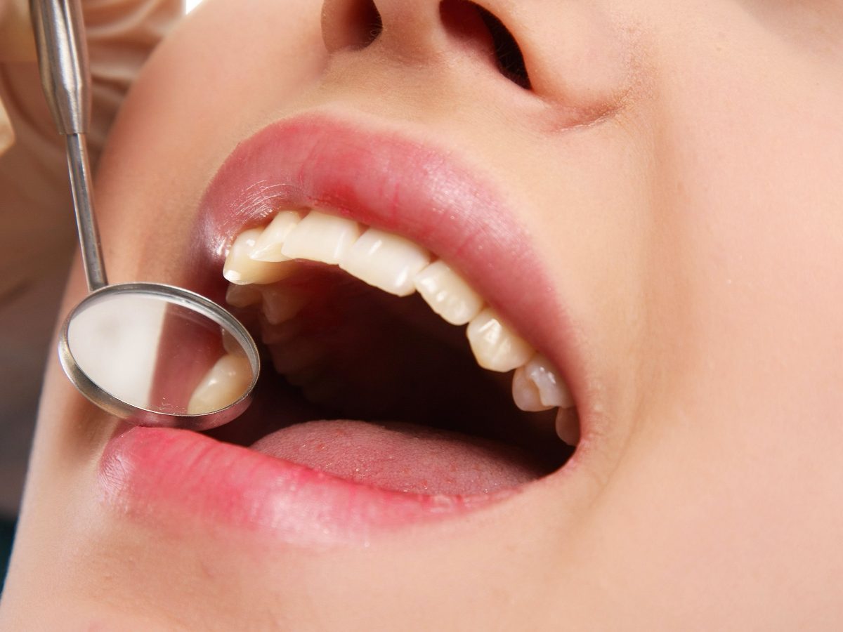 Kako i zašto vremenom zubi postaju “oštriji”?